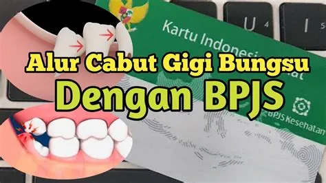 cabut-gigi-bungsu-bpjs-Cabut-Gigi